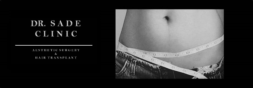 abdominoplasty-m